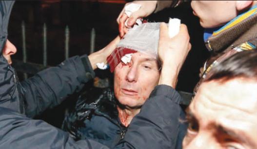 Yuriy Lutsenko get first aid after he was beaten 10 times by Berkut